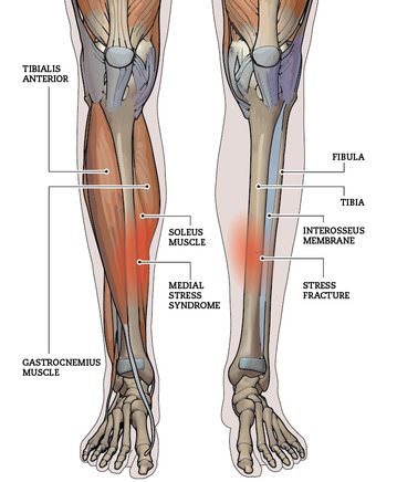 Shin Splint Anatomy