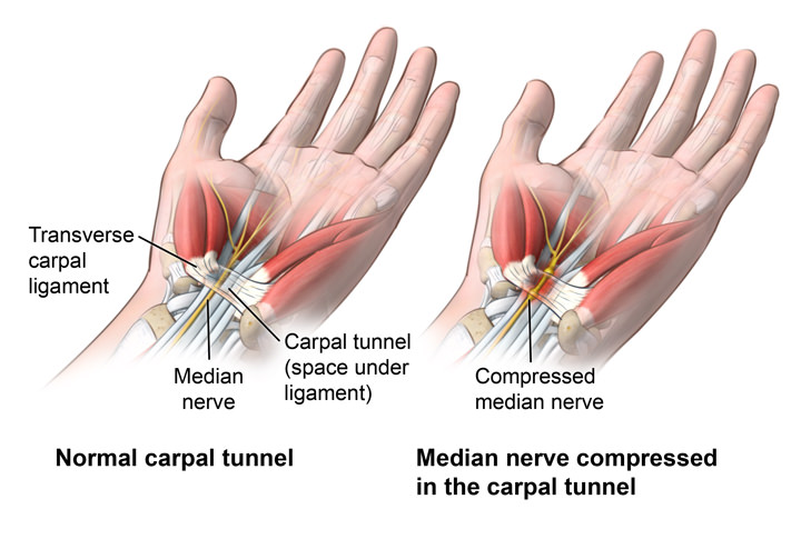 Carpal Tunnel Syndrome Anatomy