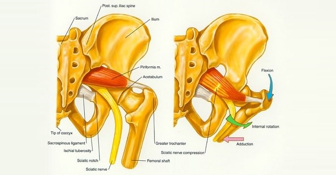 Hip and buttock pain while driving - Hip Pain Help