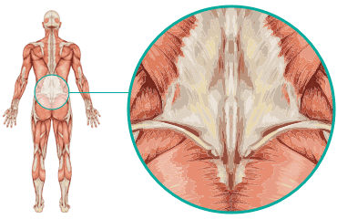 Lower Back Causes Treatments Local Physio