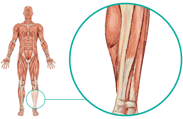 Shin - Causes & Treatments | Local Physio