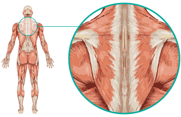 Upper back pain - Upper back - Manchester Physio - Leading